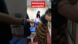 Ankylosing spondylitis treatment 93085113578409313131 drrajneeshkant [upl. by Timon]