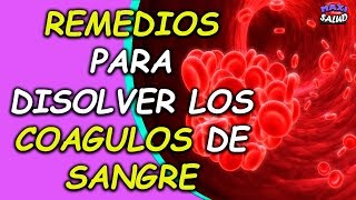 6 tratamientos naturales que te ayudan a disolver los coágulos de sangre [upl. by Nicolella]