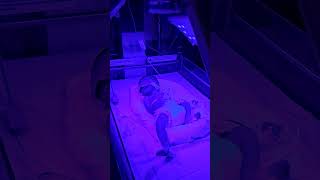 Phototherapy of baby baby nicu cutebaby [upl. by Rfinnej]