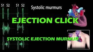 Ejection Click And Systolic Ejection Murmur pf Heart Sound [upl. by Airogerg903]