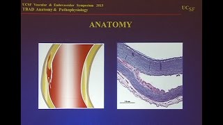 Pathophysiology and Anatomy of Aortic Dissection [upl. by Morten]