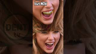 Taylor Swift teeth then and now before and after surgery tooth transformation throughout the years [upl. by Lucia]