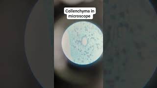 Collenchyma tissue under compound microscope [upl. by Berkley308]