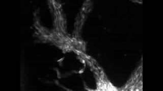 Slime mold formation [upl. by Shannan]