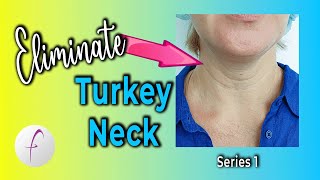 Do this Daily to Tighten amp Tone TURKEY NECK and NECK LINES [upl. by Ignazio]