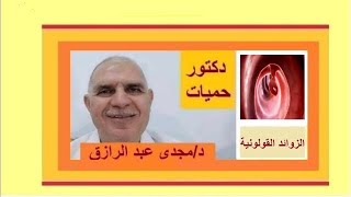 الزوائد القولونية والأورام الحميدة [upl. by Kelci]