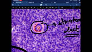 Practical Histology second year lab 2 glandular epithelium [upl. by Ellegna712]