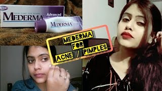 Mederma Advanced Scar Gel  For Acne Scars  मुंहासो पर प्रयोग करने का सही तरीका  Shruti Mishra [upl. by Pirzada]