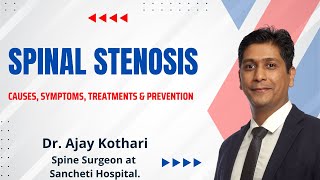 Spinal Stenosis Explained Causes Symptoms Treatments amp Prevention  Dr Ajay Kothari [upl. by Cyna]