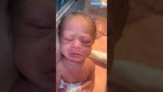 Newborn at Birth Video medical viralvideo [upl. by Tsew]