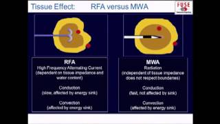 PG Fundamental Use of Surgical Energy FUSE Ablation Technologies  RFA Microwave HIFU [upl. by Enilesor493]