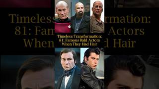 Timeless Transformation 81 Famous Bald Actors when They Had Hair [upl. by Sicard]