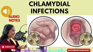 Chlamydia Infections Causes Symptoms and Treatment Options Audio Notes [upl. by Sewell288]