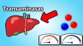 Transaminasas Altas EXPLICACIÓN EN 5 MINUTOS  Patología Clínica101 [upl. by Niwled]