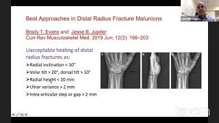 Malunited Distal Radius Fractures [upl. by Noevad]