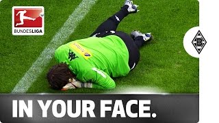 Ouch Headache Hero Yann Sommer Takes One in the Face [upl. by Robertson]