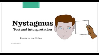 Nystagmus  test and interpretation Essential medicine [upl. by Bosch]