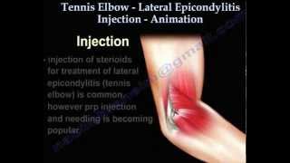 ORTHOMED Elbow US guided Injection [upl. by Vinia669]