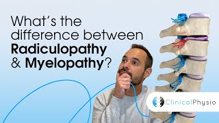 What’s the difference between Radiculopathy and Myelopathy  Expert Physio Guide [upl. by Adriena684]