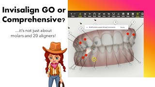 Invisalign ClinCheck Choosing between iGo vs Comprehensive  IPR tips [upl. by Aneerol629]