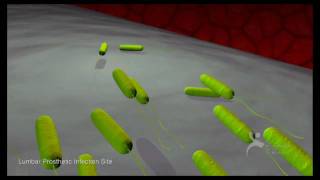 What Are Bacterial Biofilms A Six Minute Montage [upl. by Ahsenaj]