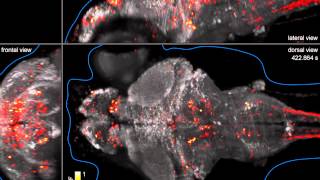 Wholebrain imaging of neuronal activity in a larval zebrafish [upl. by Libyc]