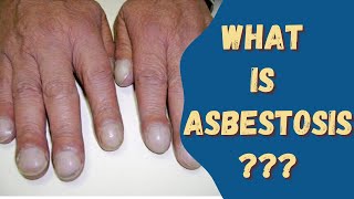 Asbestosis Asbestos disease Sign amp Symptoms Causes and risks [upl. by Kcirtemed]