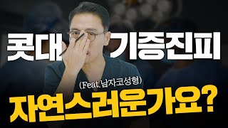 250화 콧대기증진피 자연스러운가요 feat남자코성형 [upl. by Nerac]