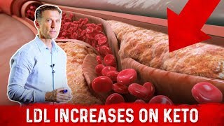 Cardiologist Dr Nadir Ali Explains LDL Bad Cholesterol Spike With Keto – DrBerg [upl. by Ailekat]