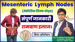 Mesenteric lymph nodes Treatment  adults  Without surgery  homeopathy मेसेंटेरिक लिम्फैडेनाइटिस [upl. by Nnaycnan419]