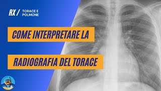 Come interpretare la radiografia del torace [upl. by Romilly]