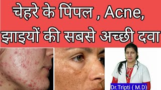 Berberis aquifoliumMedicine for acnepigmentationscars berberisaquifolium shorts acne  pimple [upl. by Nesaj]