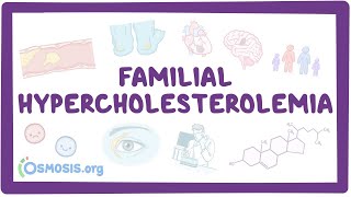 Familial hypercholesterolemia  an Osmosis Preview [upl. by Thrasher]