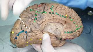 Cara medial del hemisferio izquierdo [upl. by Nolita]