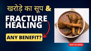 Kharode ka soup bones  fracture healing foods [upl. by Eatnad]