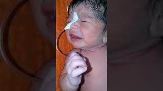 Fetal macrosomia is very weight 45 kg newborn baby after birth of this girl suction process [upl. by Minton]