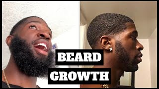 BEARD GROWTH OILS I USE [upl. by Bijan285]