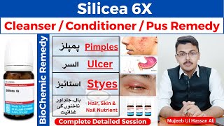 Silicea 6x Homeopathic Medicine Benefits  Silicea Homeopathic Medicine  Silicea [upl. by Teresina]