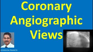 Coronary Angiographic Views [upl. by Bathulda]