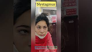 nystagmus seen in a patient I horizontal jerky eye movements l central nystagmus neurology shorts [upl. by Uella186]