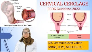 Cervical Cerclage RCOG Guideline2022 [upl. by Lewak]