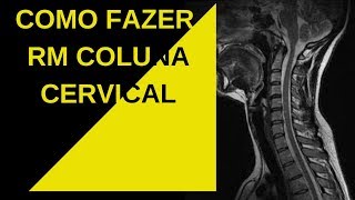 Como fazer RM da Coluna Cervical [upl. by Yreffoeg]