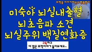 미숙아 뇌실내출혈 두개내 출혈과 뇌실주위 백질연화증periventricular leukomalacia [upl. by Airetnuhs870]