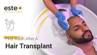 First Hair Wash After A Hair Transplant hairtransplant hairtransplantturkey [upl. by Aramas]