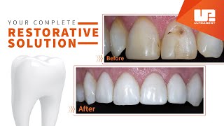 Ultradent Opalustre инструкция по применению [upl. by Hayikat25]