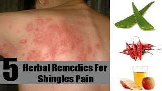 5 Ways to Get Rid of Shingles Fast and Naturally  By Top 5 [upl. by Atinauq459]