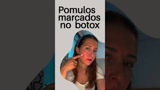 POMULOS MARCADOS SIN BOTOX yogafacial pomulos tips nobotox arrugas wellbeing autolifting [upl. by Athelstan]