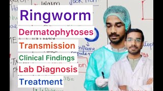 Ringworm  Dermatophytoses  Properties  Clinical  Transmission  Treatment [upl. by Onailerua933]