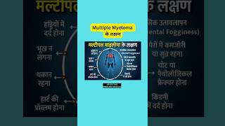 Symptoms of multiple myeloma shortsfeed multiplemyeloma drstethombbsmdmedicine health trending [upl. by Eidda]