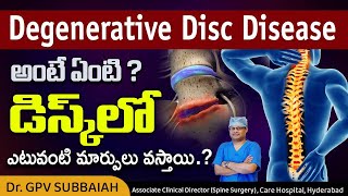 What is degenerative disc disease DDD   What happens in the disc in DDD  Dr GPV Subbaiah [upl. by Kelula]